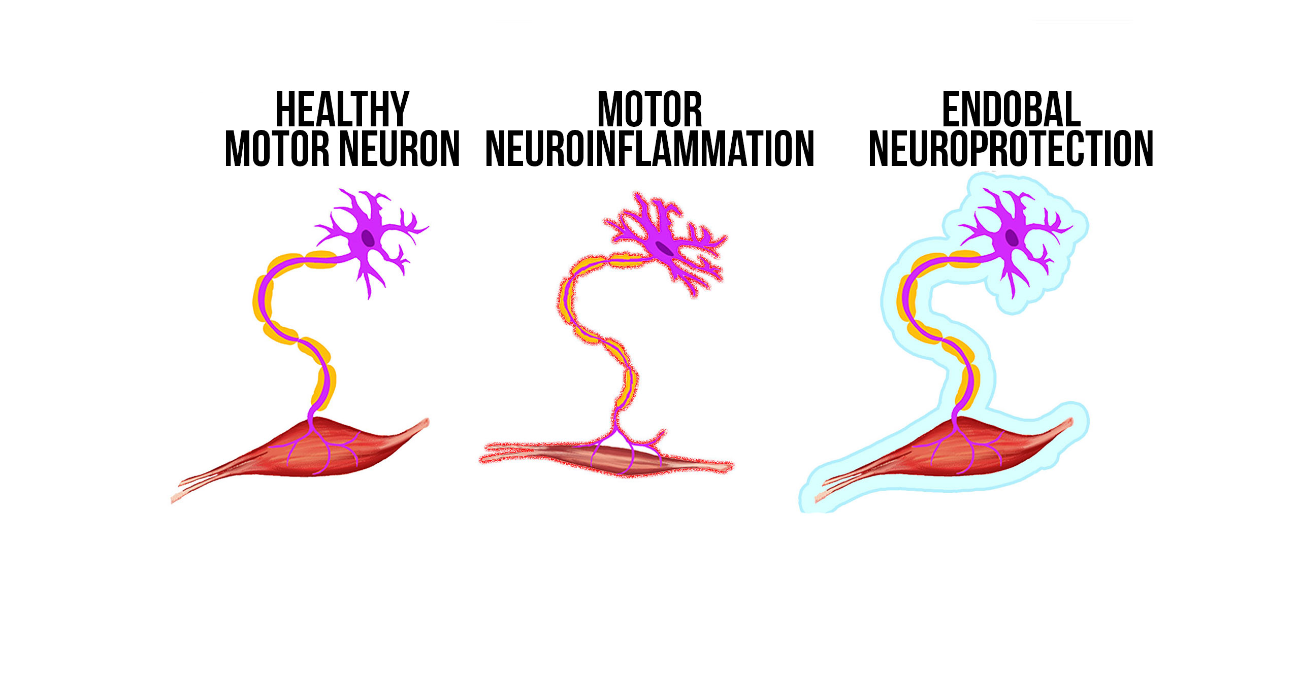 ENDOBAL™ has Neuroprotective Properties